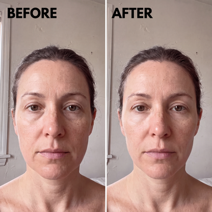 Lymphatic Drainage Drops